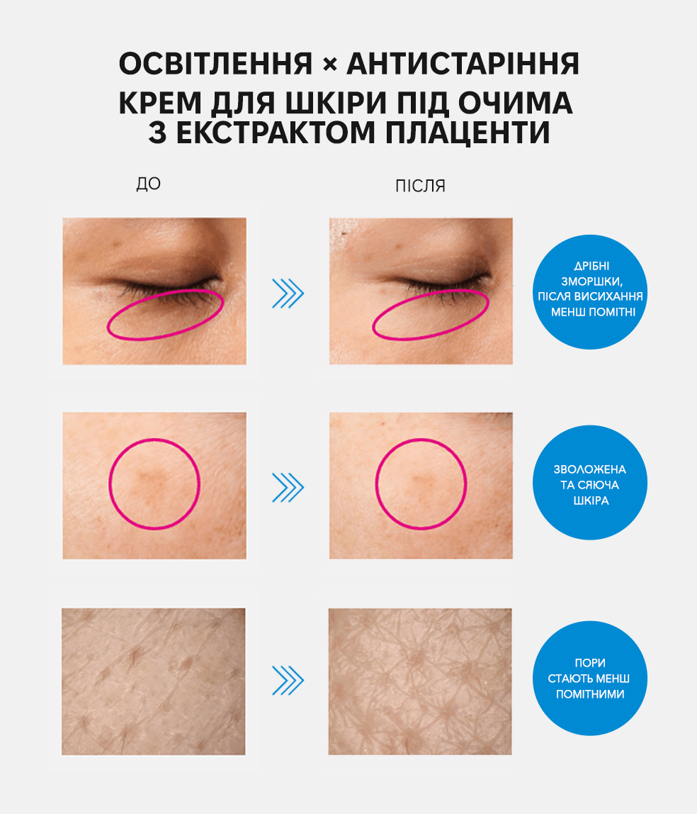 Meishoku Medicated Placenta Whitening Eye Cream - Крем для кожи под глазами