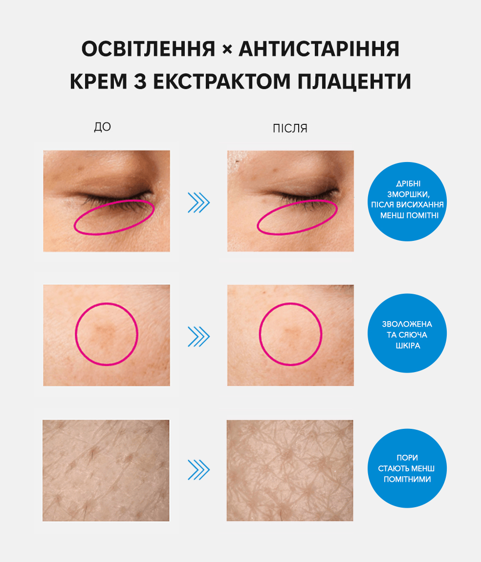 Meishoku Medicated Placenta Whitening cream - Крем против пигментных пятен